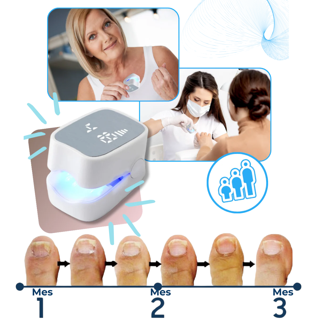 MyCurePro® Revitalización avanzada antihongos
