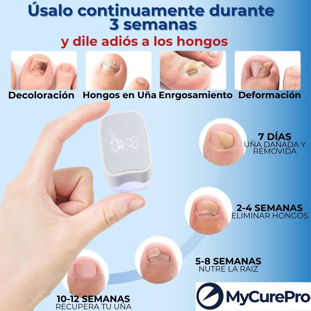 MyCurePro® Revitalización avanzada antihongos