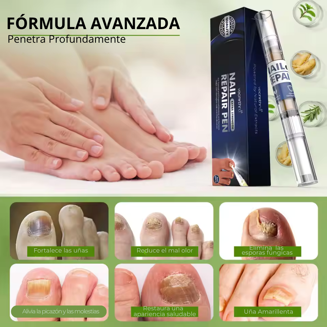 MyCurePro® Lápiz Antifúngico con Fórmula Avanzada – Contra Pie de Atleta y Hongos en Uñas