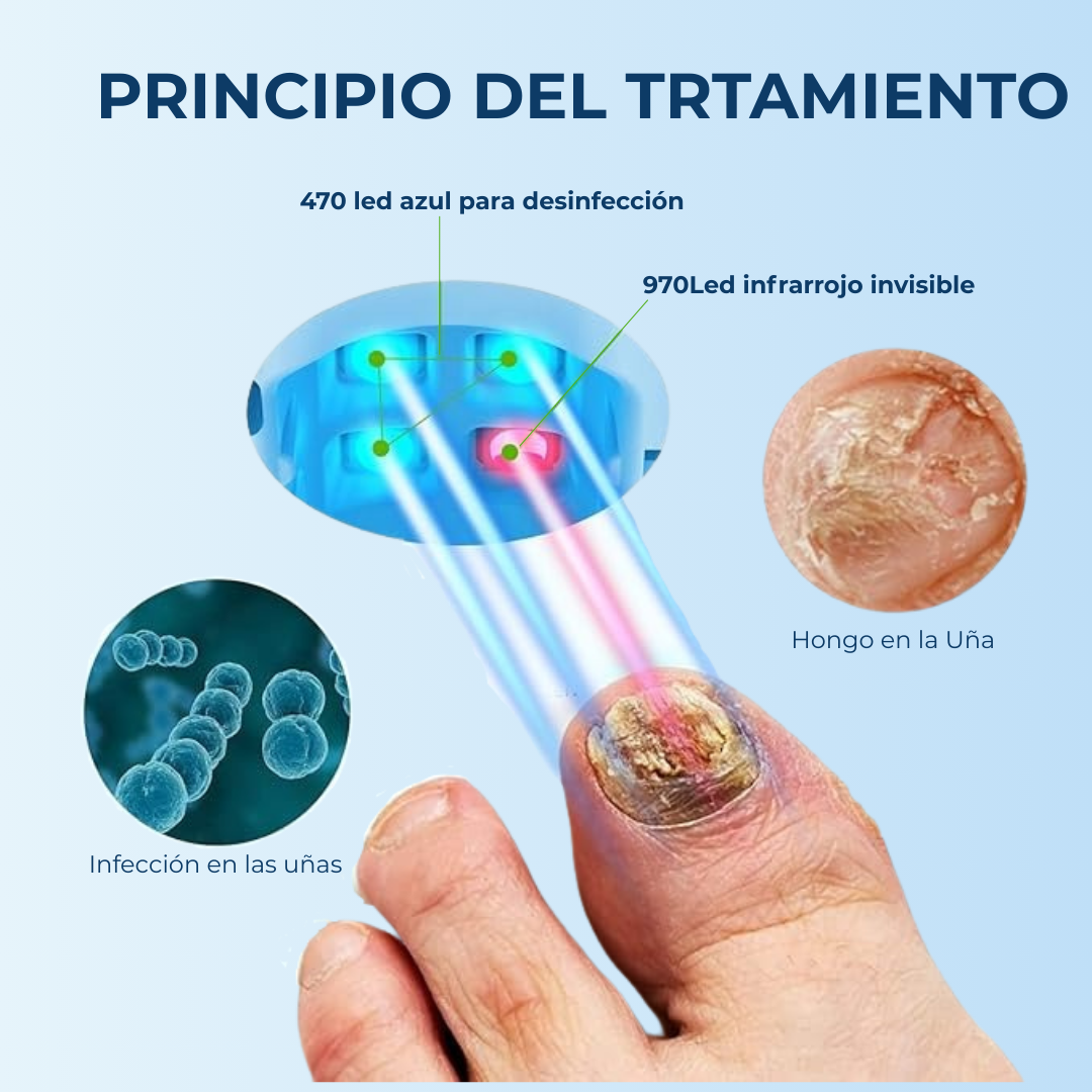 MyCurePro® Revitalización avanzada antihongos
